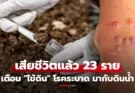 โรคมากับดินน้ำ! “ไข้ดิน” เสียชีวิตแล้ว 23 ราย ป่วย 732 ราย เตือนเกษตรกร กลุ่มเสี่ยง รีบเช็กอาการ