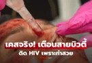 โลกนี้อยู่ยาก! หญิง 3 ราย ติด HIV ทั้งที่ไร้พฤติกรรมเสี่ยง อึ้ง พบต้นเหตุ จาก “ทำสวย”