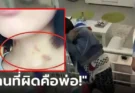 พ่อด่าเดือด ลูกสาววัย 15 บนคอมี “รอยช้ำสีแดง” เจอร่ายยาวโต้กลับ ปัญหาเกิดจากใคร?!