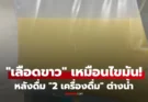 ช็อก! ชายวัย 29 เลือดเป็นสีขาวข้น เหมือน “ไขมันหมู” เหตุดื่ม “2 เครื่องดื่มนี้” ต่างน้ำนาน 6 เดือน!!