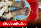 เจ็บปวดเกินวัย! ป.5 ข้ออักเสบทรุดเพราะโรคเกาต์ เปิด 5 อาหารอันตรายที่คนส่วนใหญ่ชอบป้อนให้ลูกกินทุกวัน