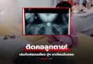 ใจสลายทั้งบ้าน ลูกสาว 3 ขวบ เล่นกับพ่อบนเตียง จู่ๆ อาเจียนหนัก ถึงมือหมอ “สายเกินไป” ตรวจศพถึงรู้มีอะไรติดคอ